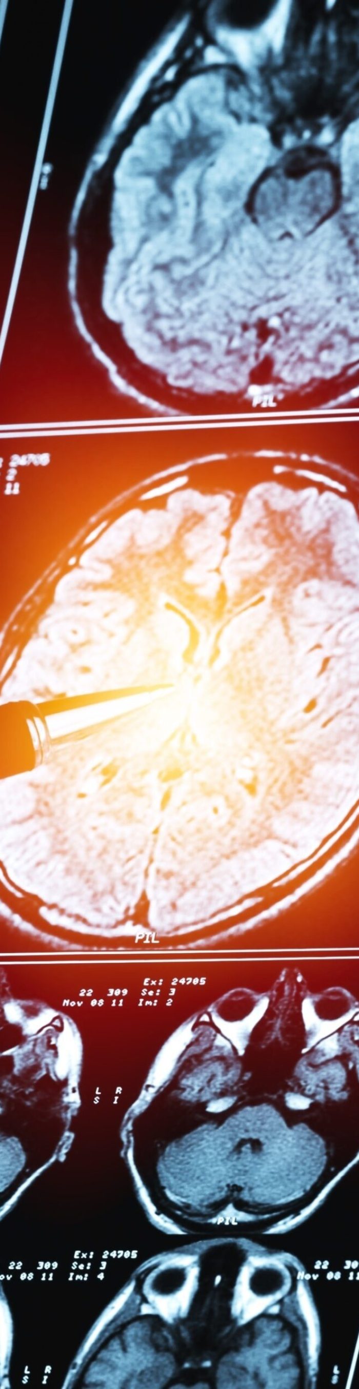 Stethoscope on a blue cloth with an illustration of a medic Stethoscope on a blue cloth with an illustration of a medic